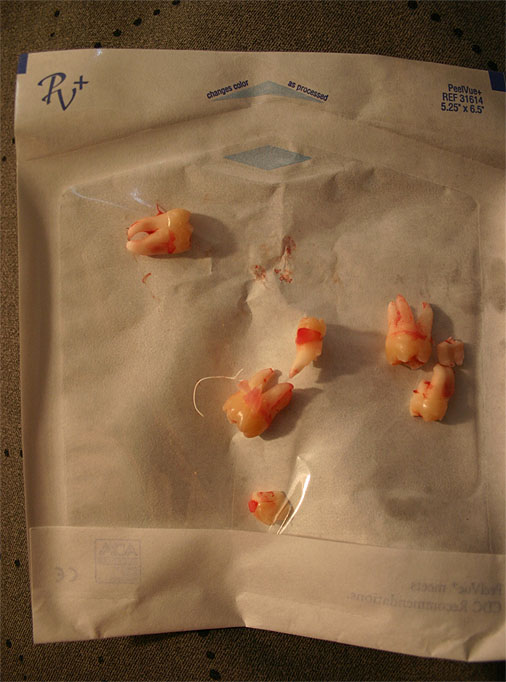 Name:  myingteeth.jpg
Views: 14
Size:  92.8 KB